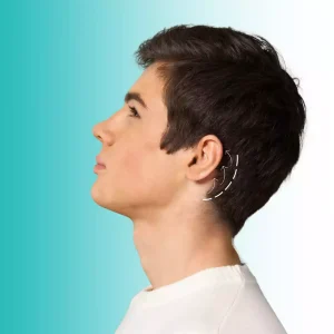 Otoplastia - Dra Angelica Sifontes