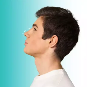 Rinoplastia Ultrasónica - Dra Angelica Sifontes